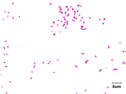 Photomicrograph of <i>Klebsiella aerogenes</i> showing bacillus shape.